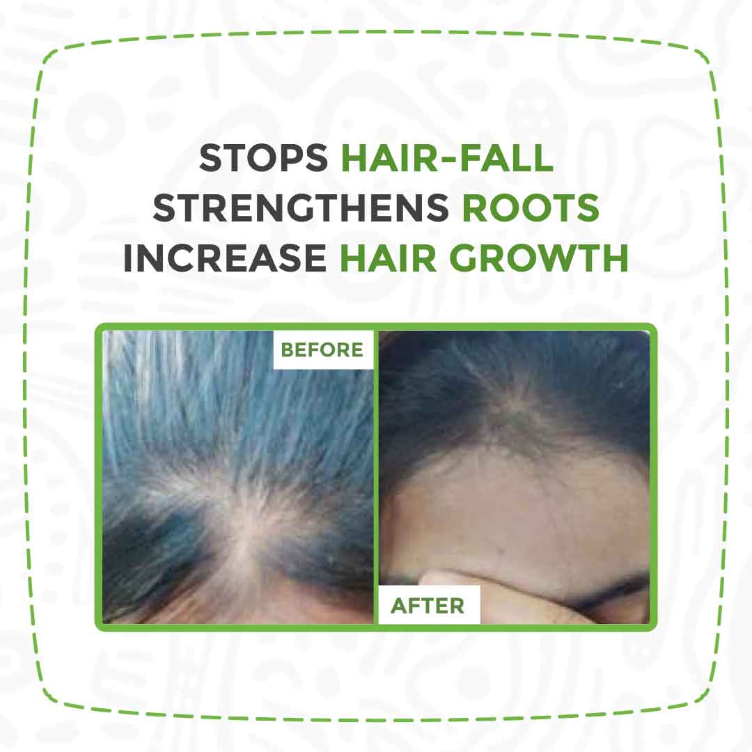 Baby Hair Growth Oil | Growing Roots and locks shine